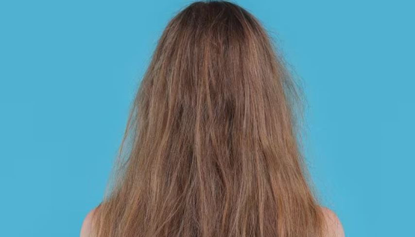 Dull hair 